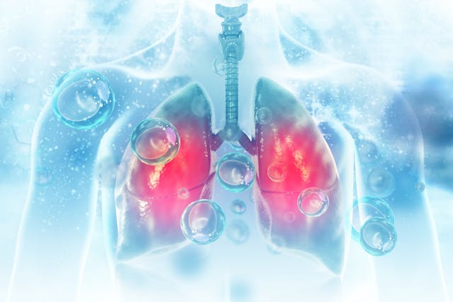 Virus and bacteria infected the Human lungs. lung disease | Image Credit: Crystal light - stock.adobe.com