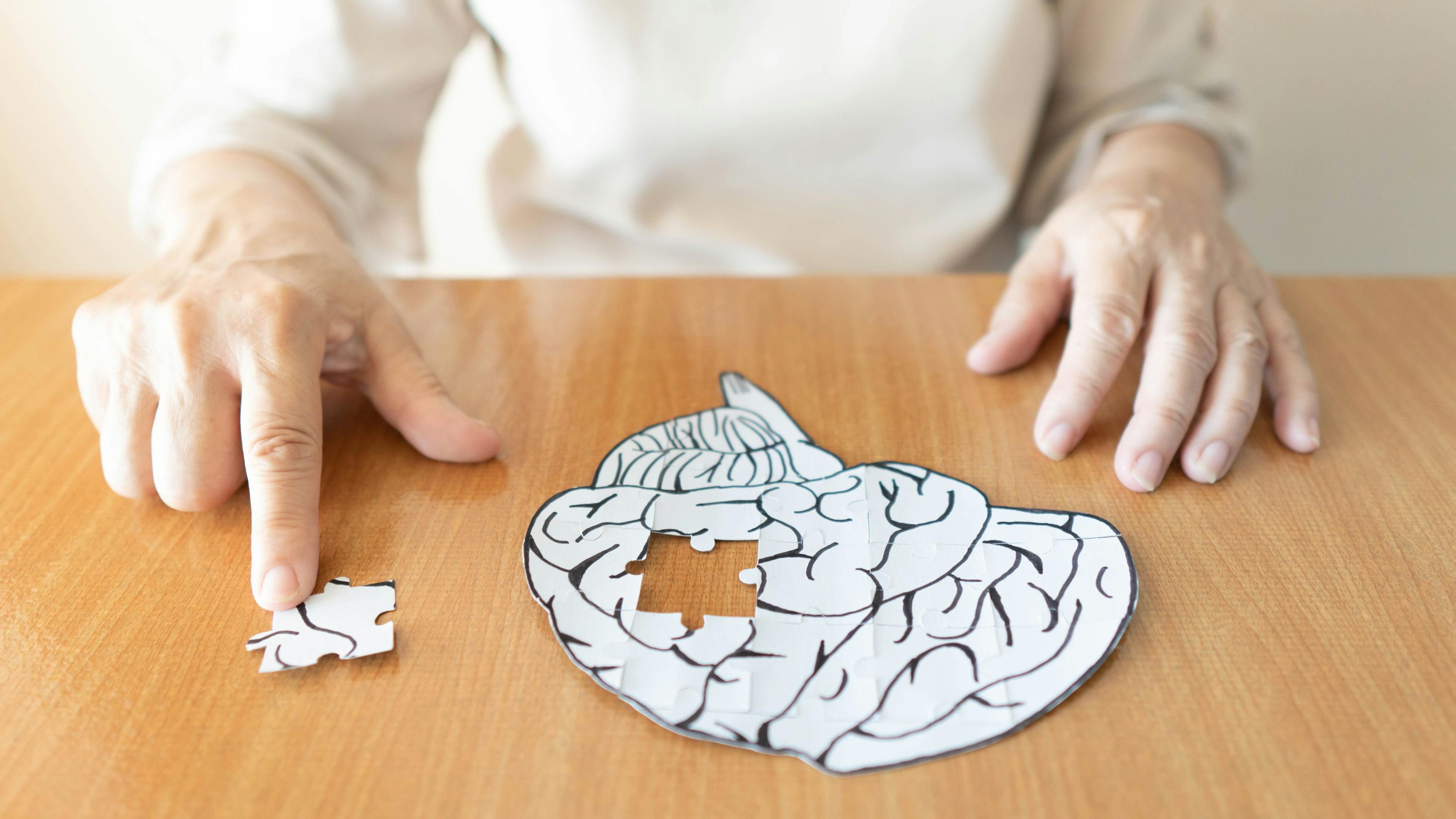 Elderly woman hands putting missing white jigsaw puzzle piece down into the place as a human brain shape | Image Credit: Orawan - stock.adobe.com