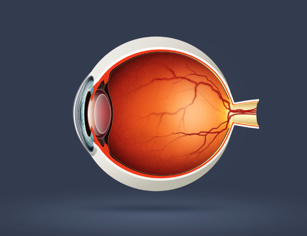 Data Show Vabysmo Effective, Safe in Treatment of Wet Age-Related Macular Degeneration 
