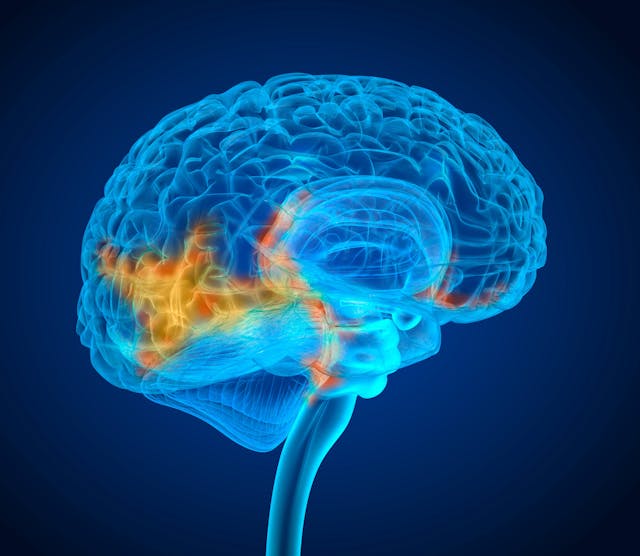 X-ray scan of brain -- Image credit: Alex Mit | stock.adobe.com