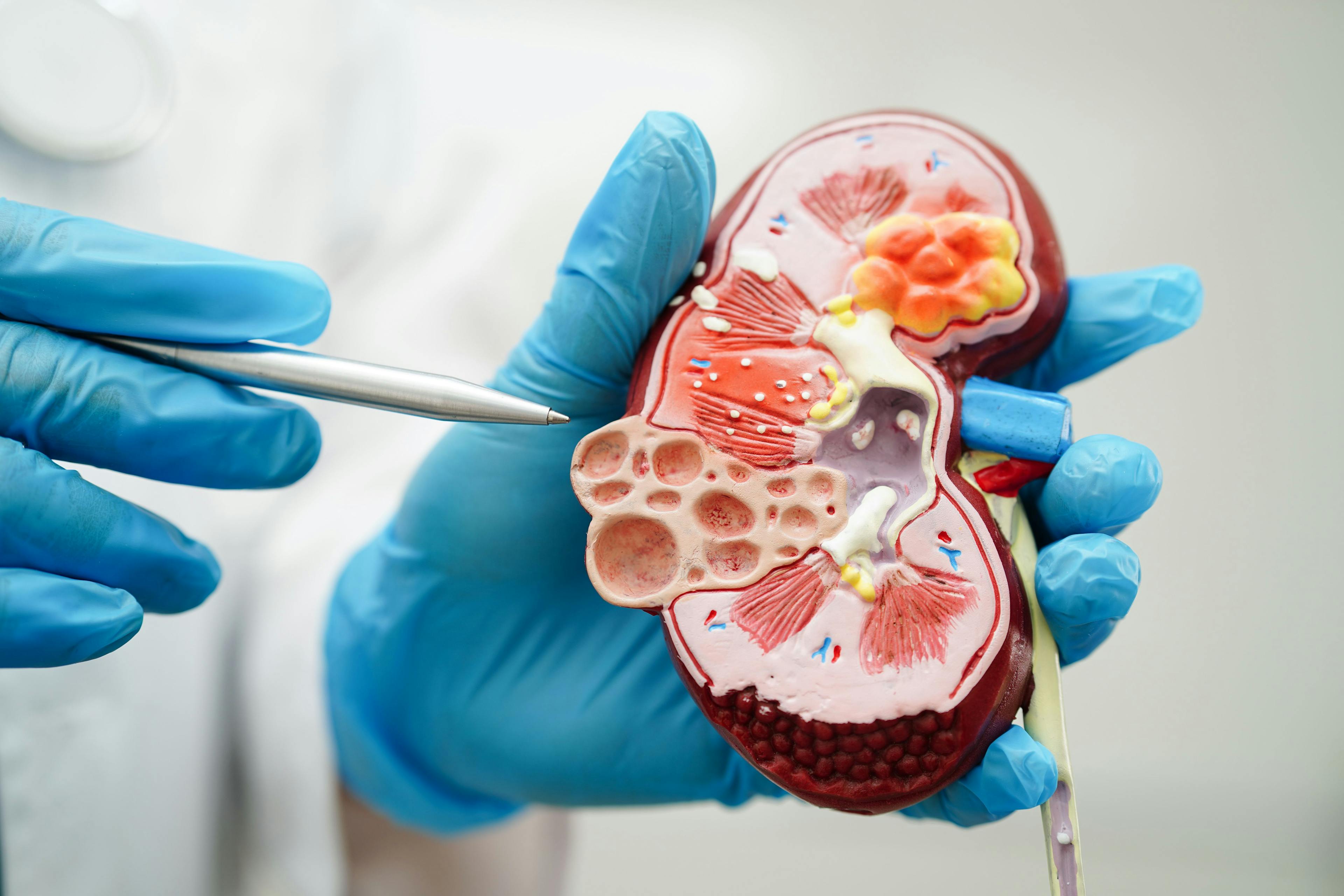 Physician holding model of a kidney