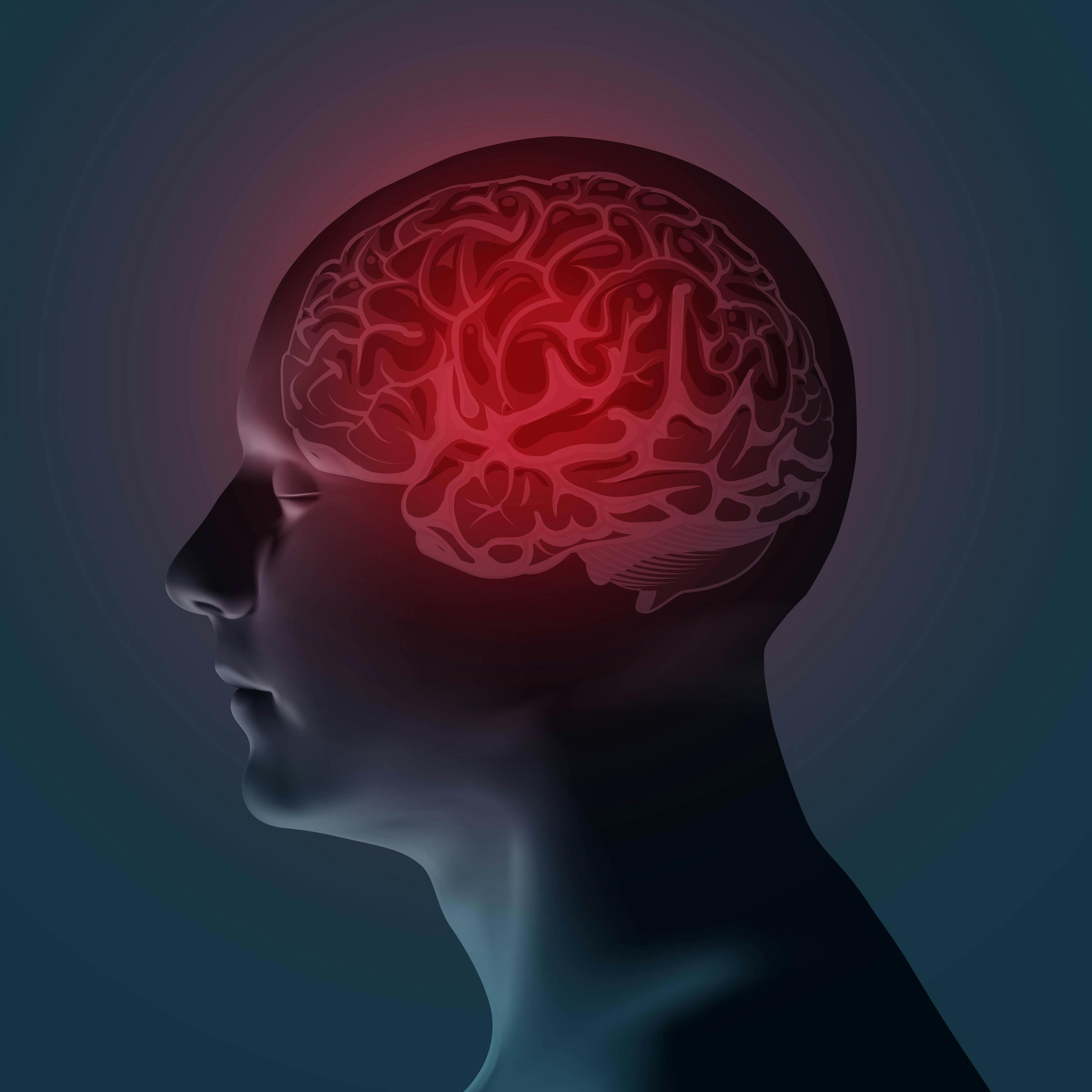 Study: Abbott’s 2 Blood-Based Biomarkers Can Predict Severity of Traumatic Brain Injury