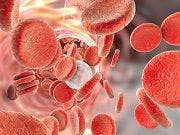Oral Drug a Candidate to Treat Anemia from Chronic Kidney Disease