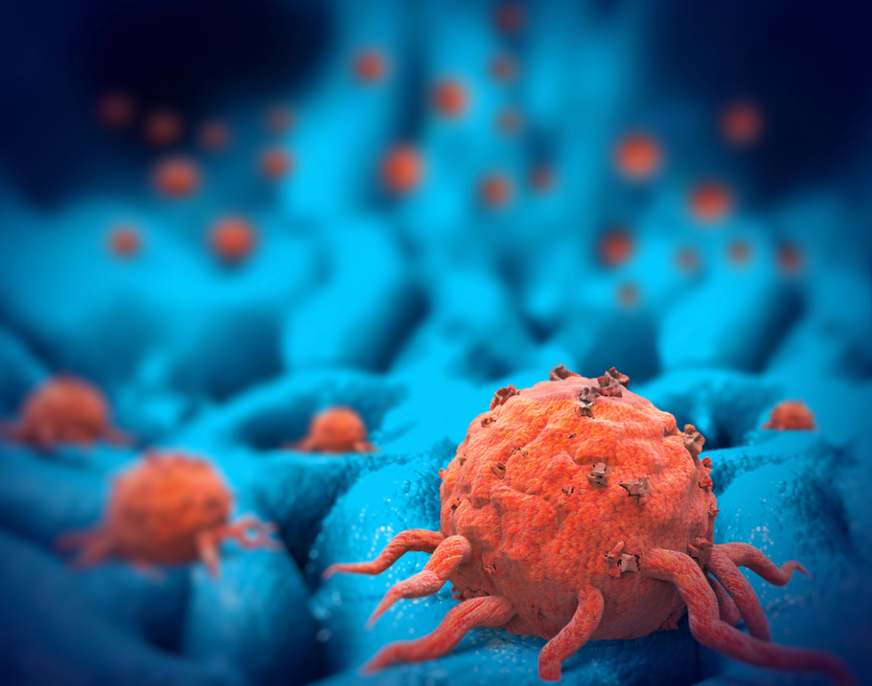 Researchers Tackle Limitations, Opportunities of CAR T Cells in Solid Tumors