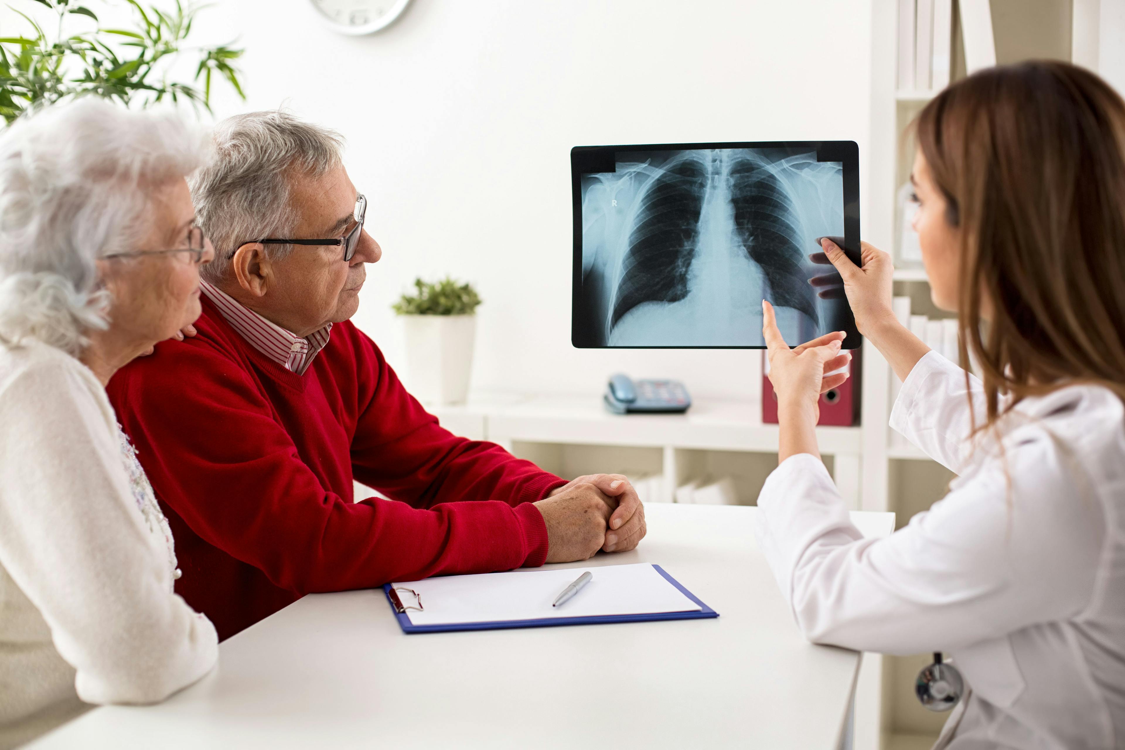 Lung Cancer, New Treatment, Improved Outcomes | Image Credit: didesign - stock.adobe.com