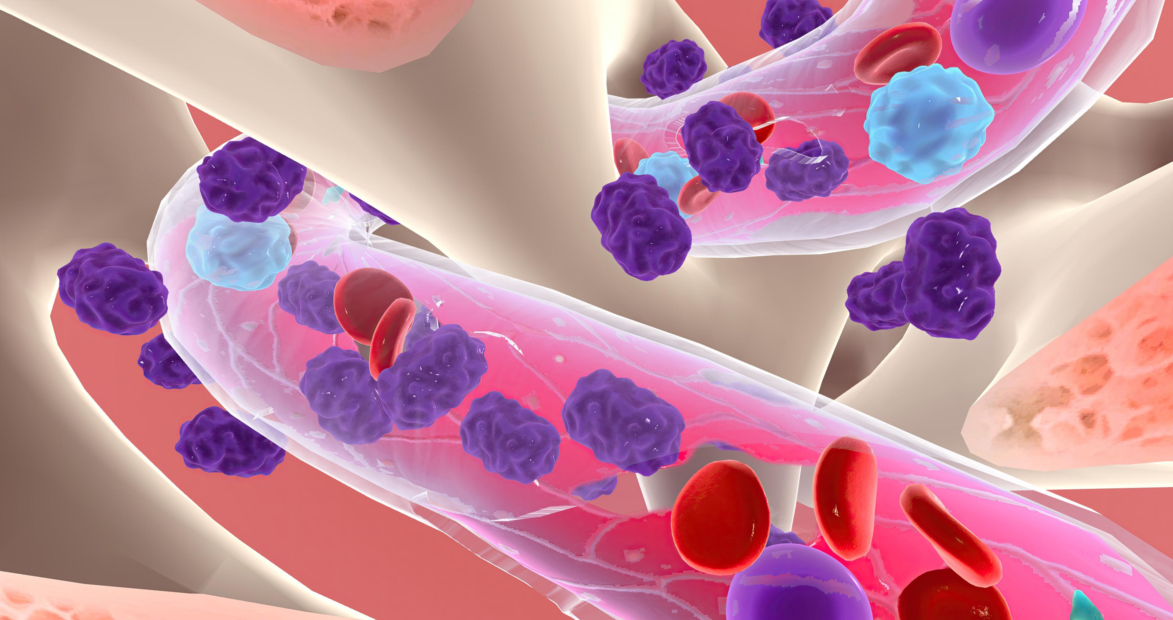 Chronic Myeloid Leukemia | Image Credit: cramedical - stock.adobe.com