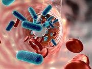 Topoisomerase 1 Inhibitors Could Prevent Sepsis-related Death
