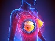 Experimental Drug Potentially More Effective Treating Breast Cancer