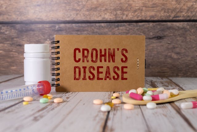 Paper with CROHN'S DISEASE on the office desk, stethoscope and pills, top view | Image Credit: Uladzislau - stock.adobe.com