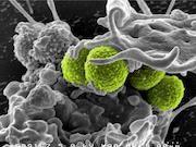 Cancer Research Reveals Pathway to Attack Drug-Resistant Superbugs