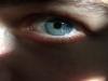 Eye Color Could Predispose Patients to Uveal Melanoma