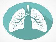 Lung Cancer Drug Improves Progression-Free Survival in Trial