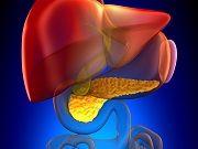 Diabetes May Indicate Undiagnosed Pancreatic Cancer