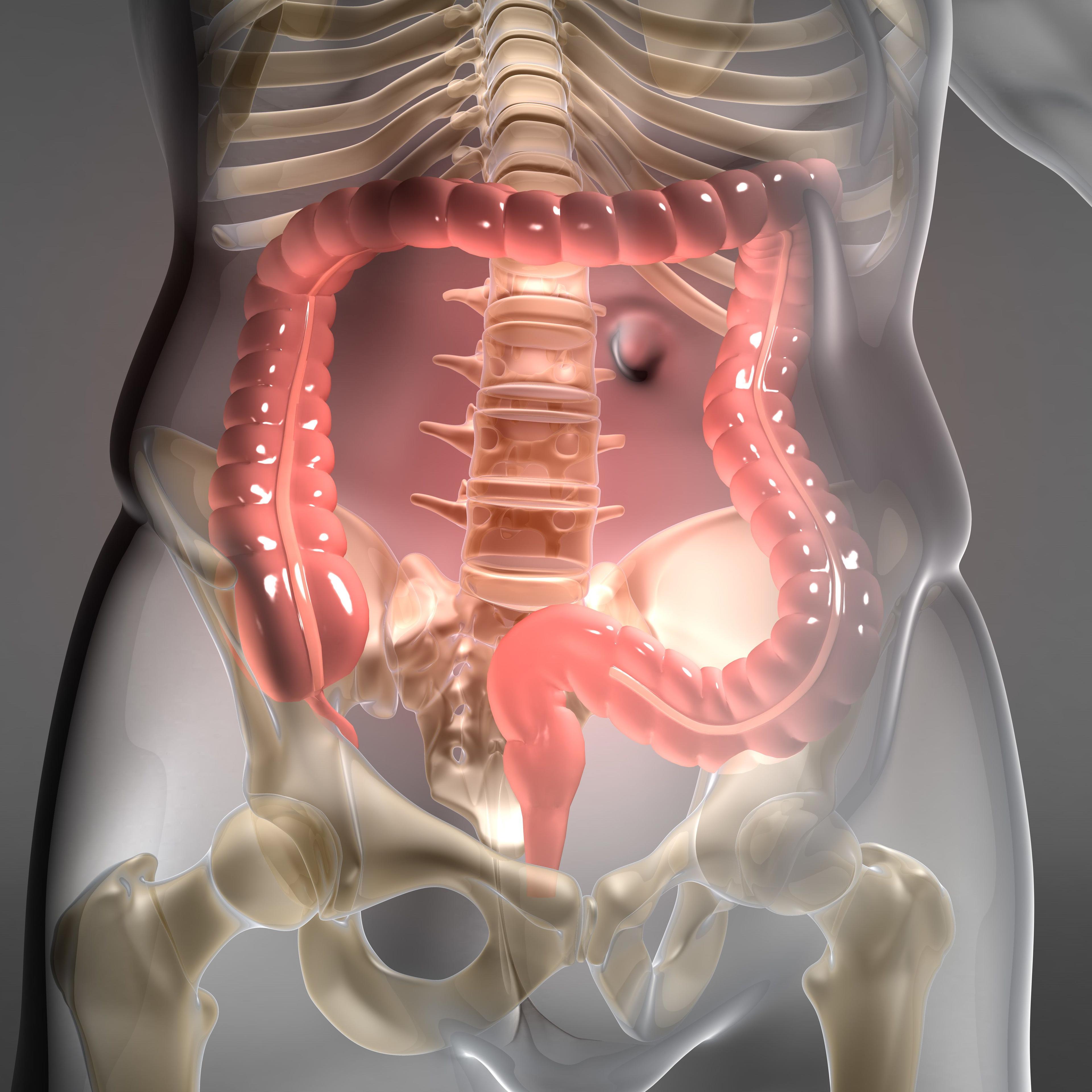 Certain BRAF Mutations in Colorectal Cancer May Respond to Anti-EGFR Therapy