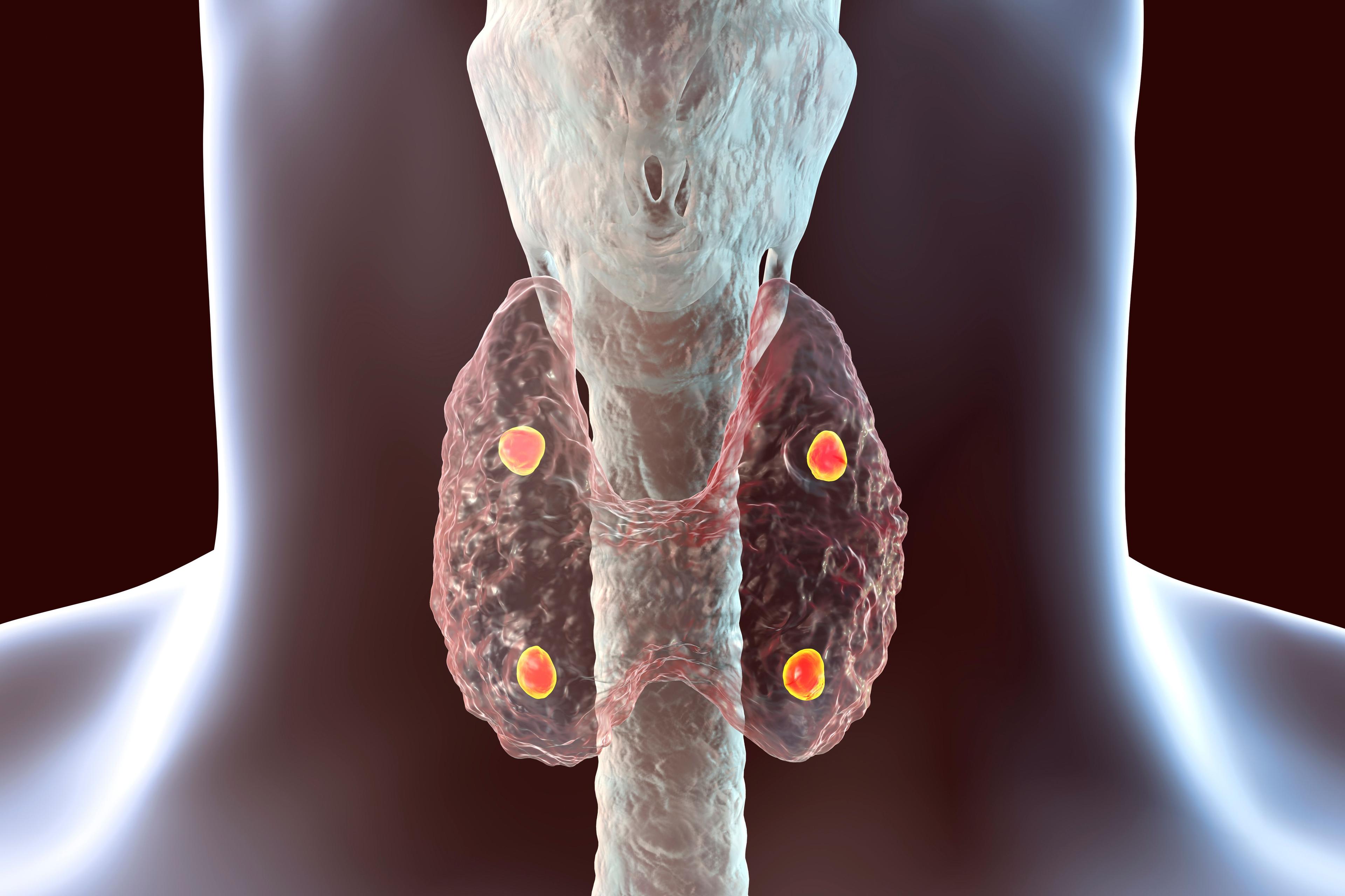 FDA Approval Endocrine | Image Credit: Dr_Microbe - stock.adobe.com