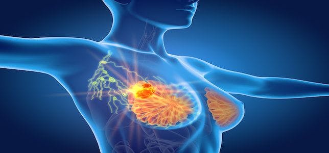 Study: Pre-Surgery Immunotherapy May Help Destroy High-Risk Breast Cancer