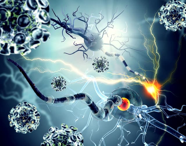 Damaged neurons in brain -- Image credit: ralwel | stock.adobe.com