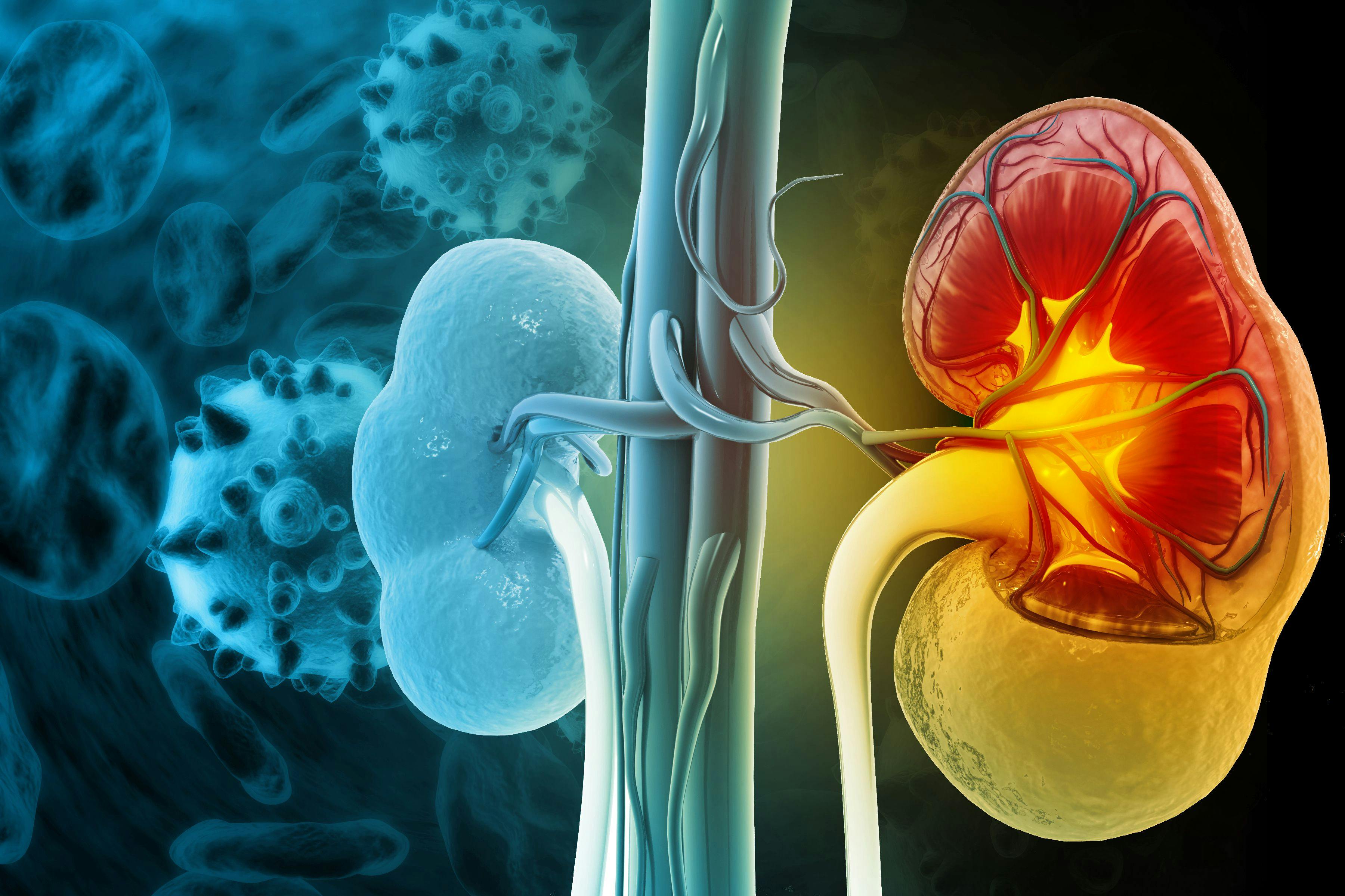 Chronic kidney disease. 3d illustration - Image credit: Crystal light | stock.adobe.com 