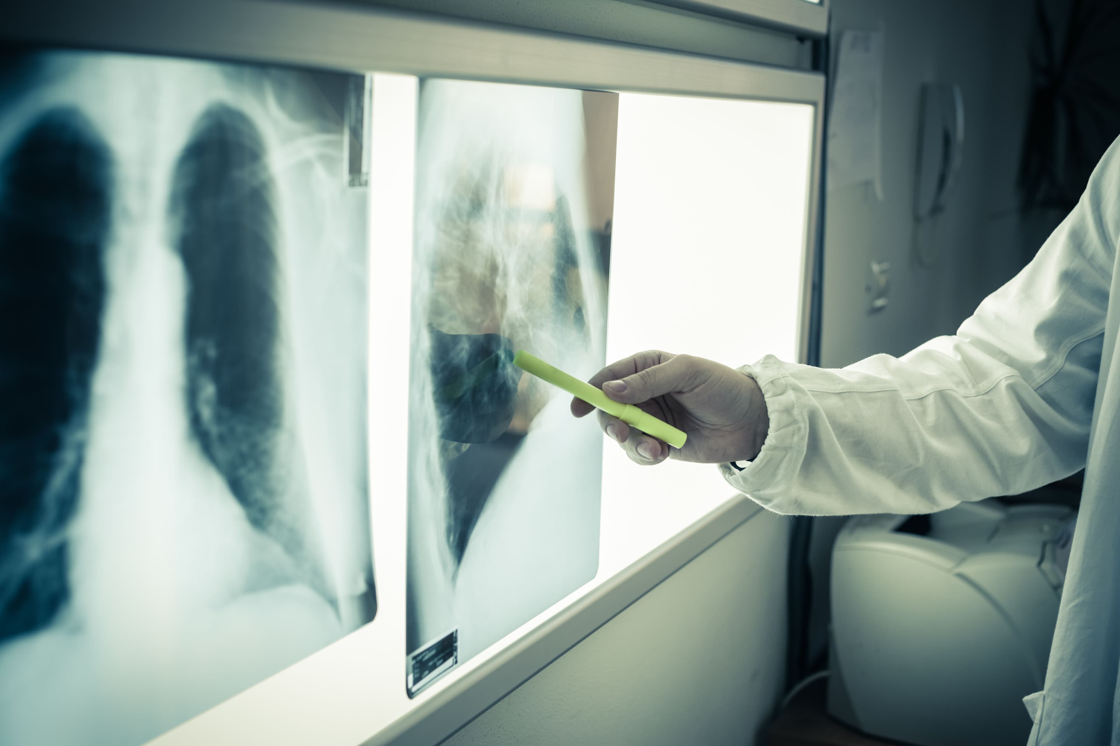 Radiography - Image credit: Dario Lo Presti | stock.adobe.com