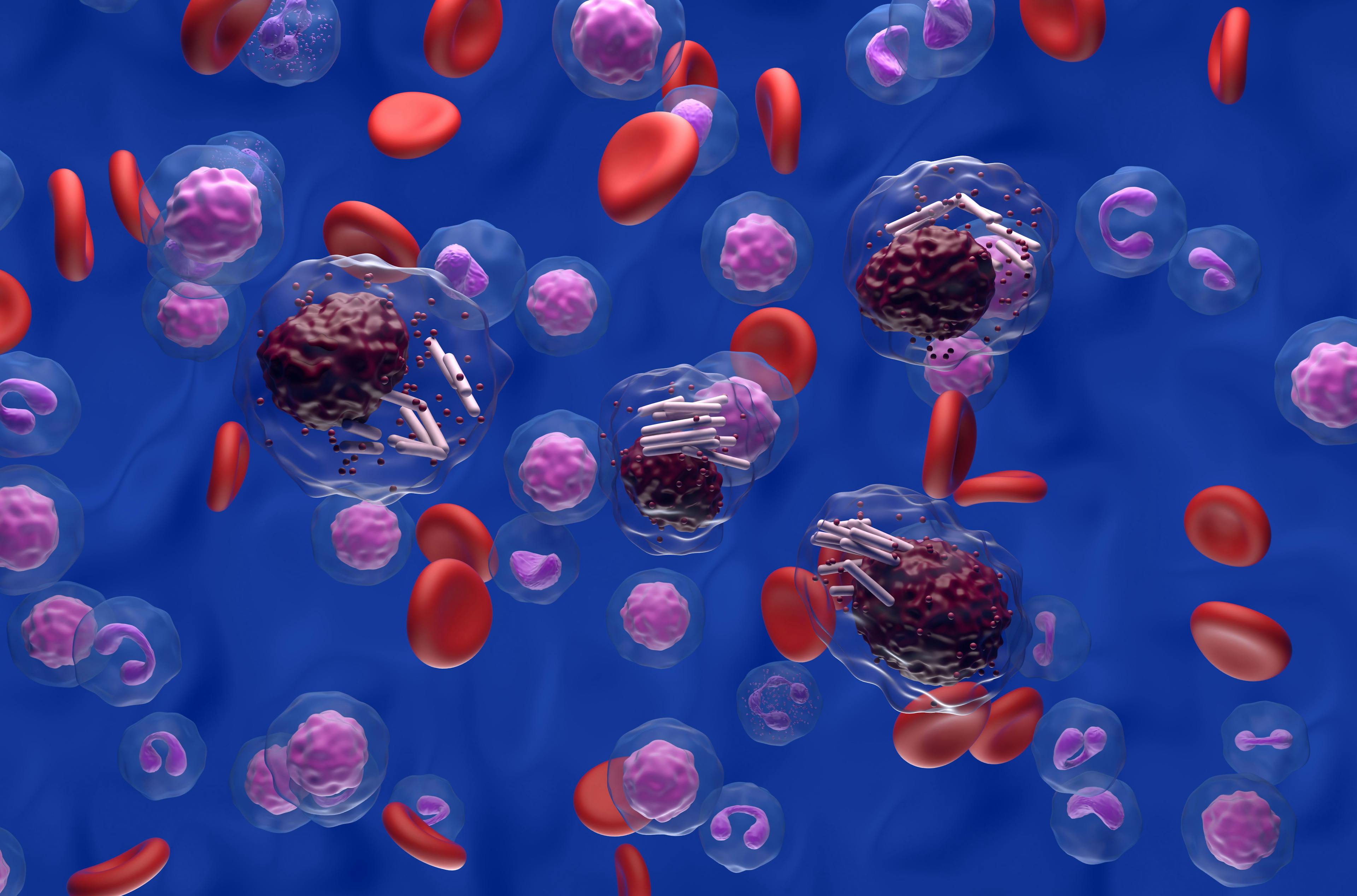 Chronic lymphocytic leukemia -- Image credit: LASZLO | stock.adobe.com