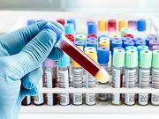 Routine Blood Test May Predict Cancer Survival