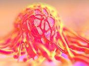 Immunotherapy May Treat Multiple Cancer Types