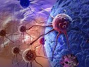 New Method to Starve Cancer Cells Discovered