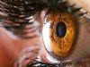 Large Proportion of Diabetics Pass on Annual Eye Exams