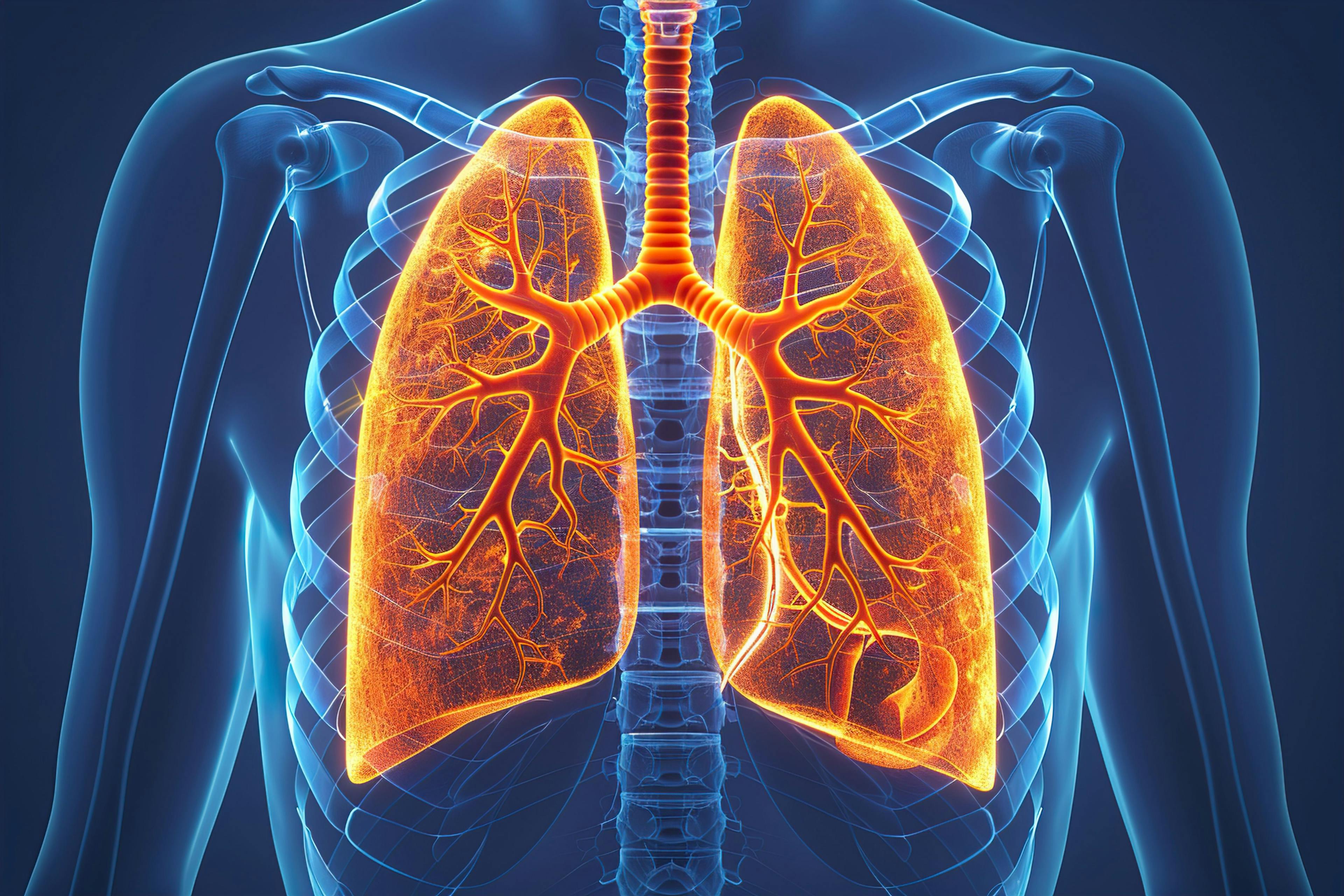 Infographic Pulmonary hypertension - Image credit: urwa | stock.adobe.com 