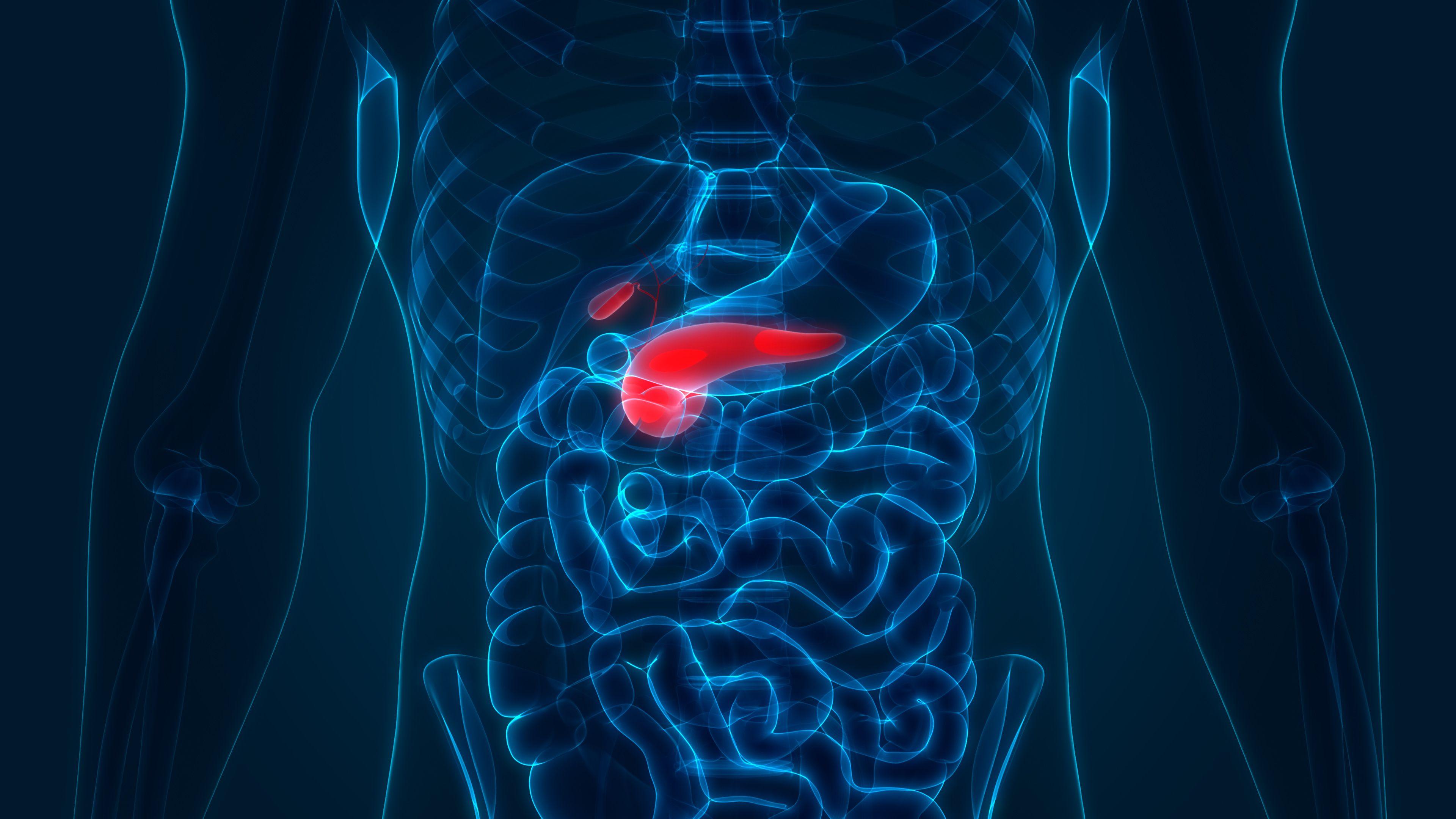 Pancreatic Cancer Has a Growing Array of Treatment Options