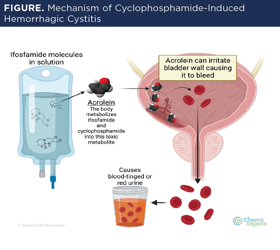 Figure: Mechanism of Cyclophosphamide-Induced Hemorrhagic Cystitis