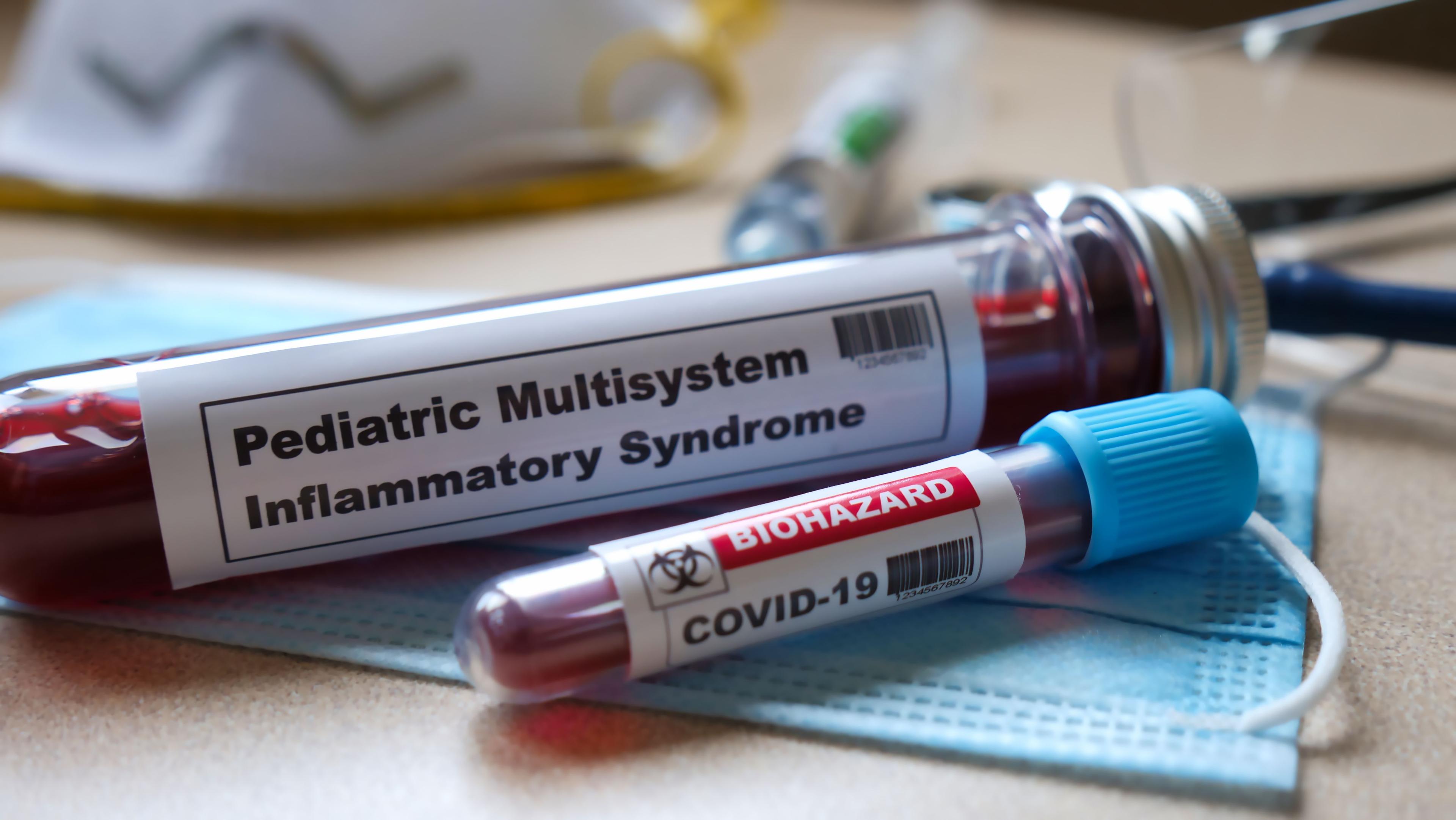 A vial of blood from a patient with pediatric multisystem inflammatory syndrome.