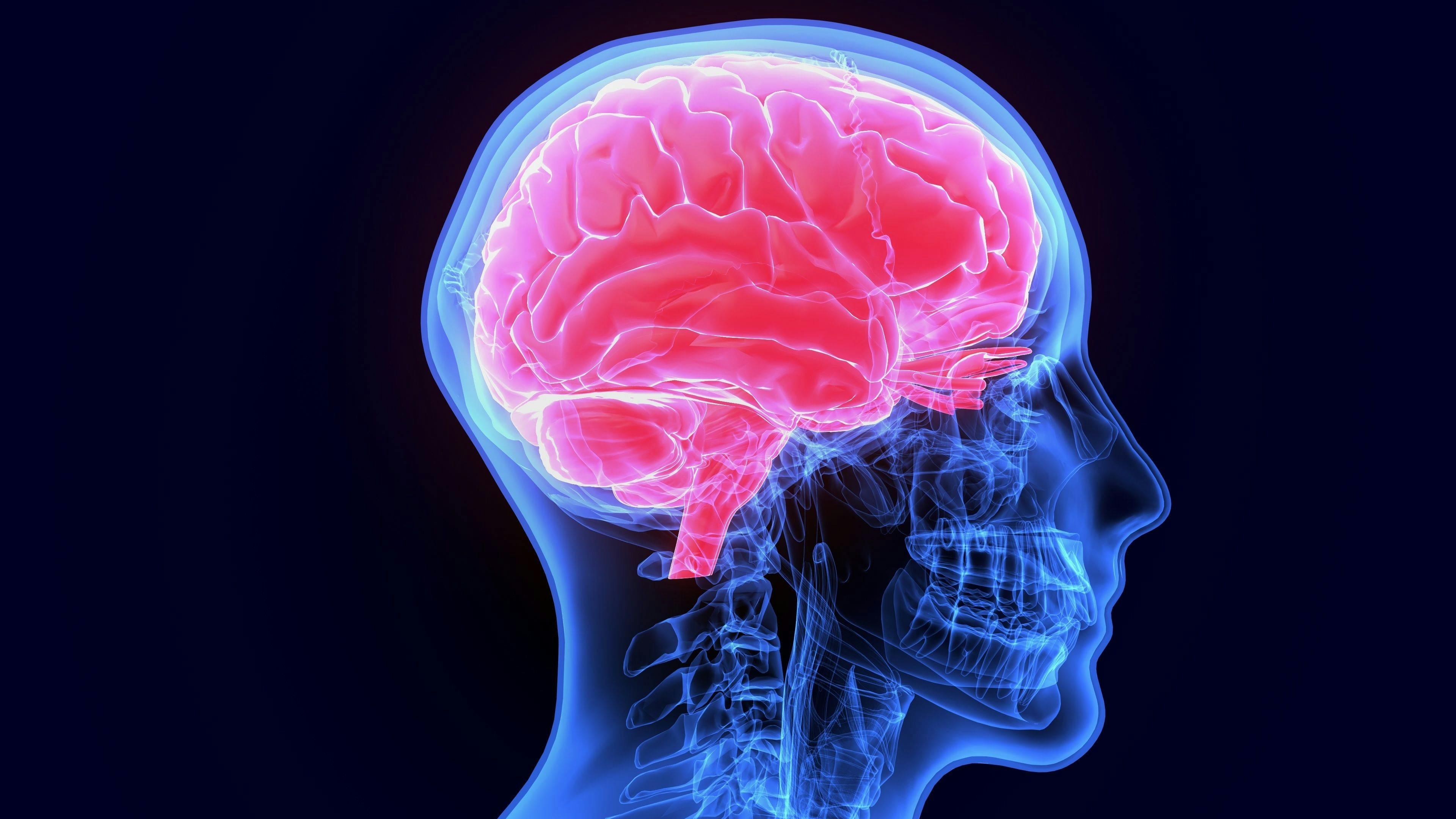 X-ray scan of brain -- Image credit: PIC4U | stock.adobe.com