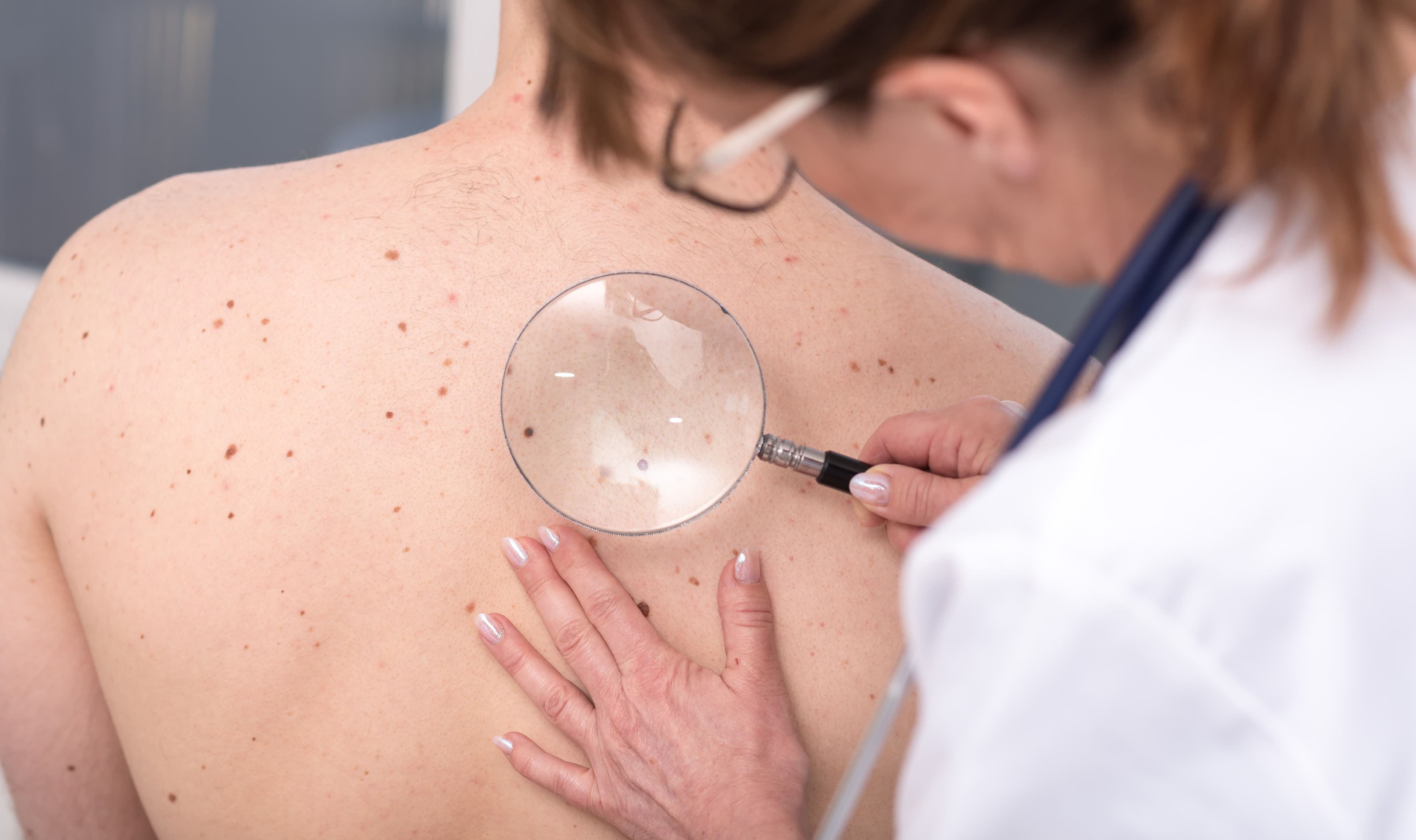 Is It A Myth?: Dermatologist Discusses Misinformation Around Dermatology Care