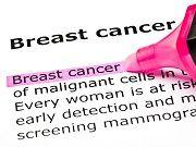 Discovery May Overcome Treatment Resistance in Breast Cancer