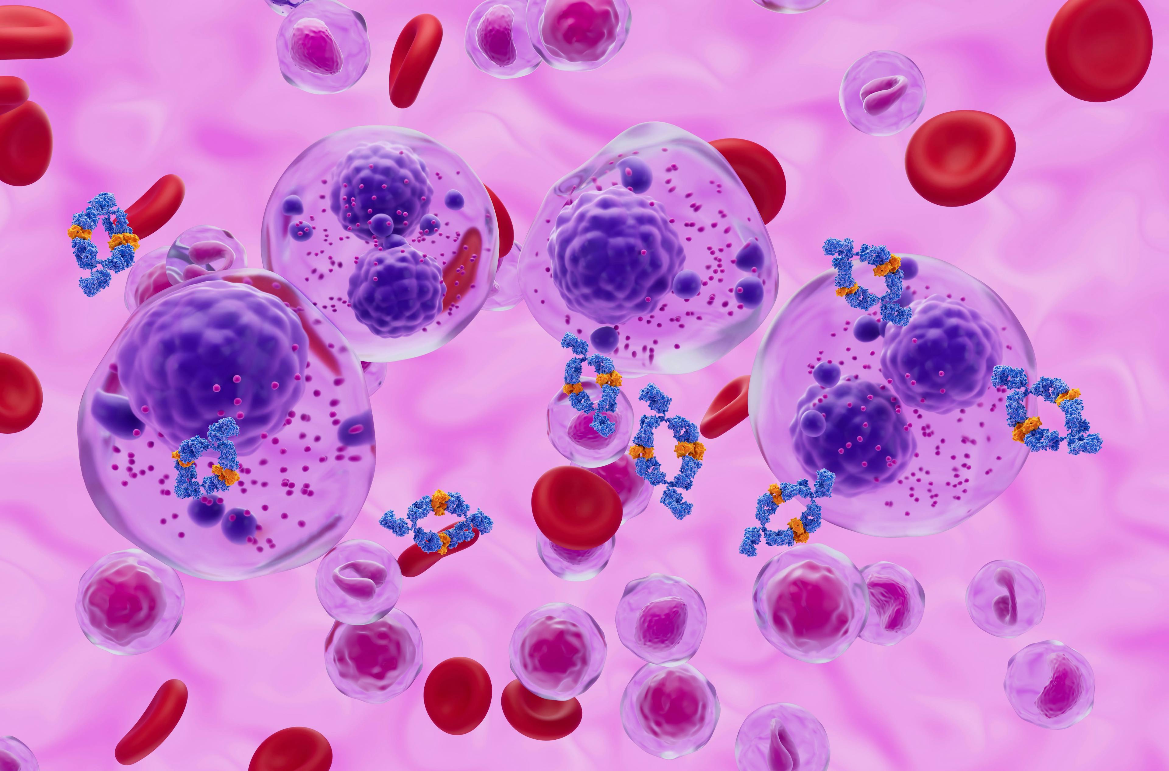 Multiple myeloma treatment -- Image credit: LASZLO | stock.adobe.com