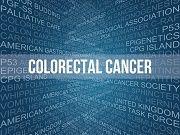 Colon Cancer Immunotherapy Successful in Small Trial