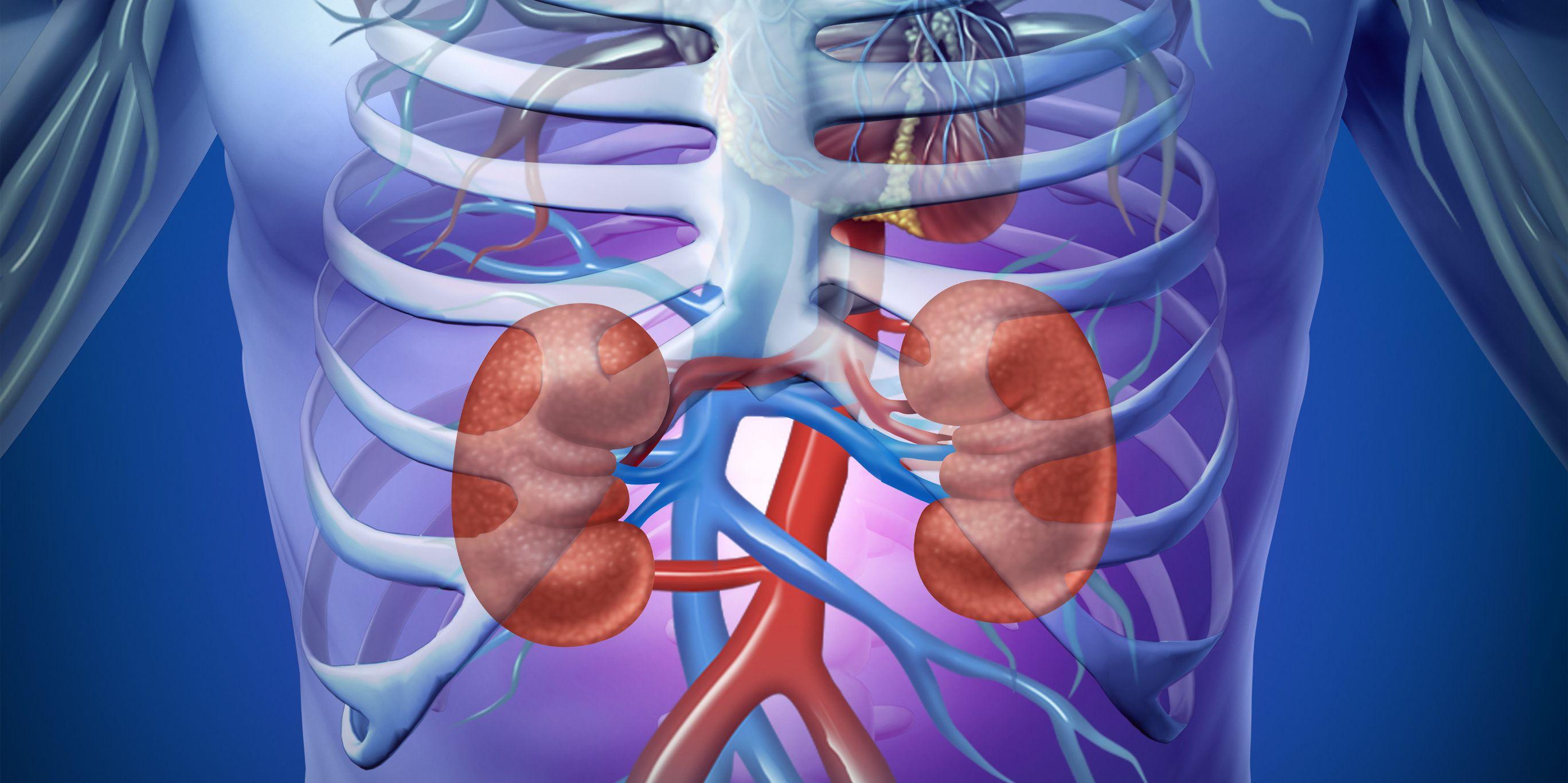 FDA Approves New Solution for Continuous Renal Replacement Therapy