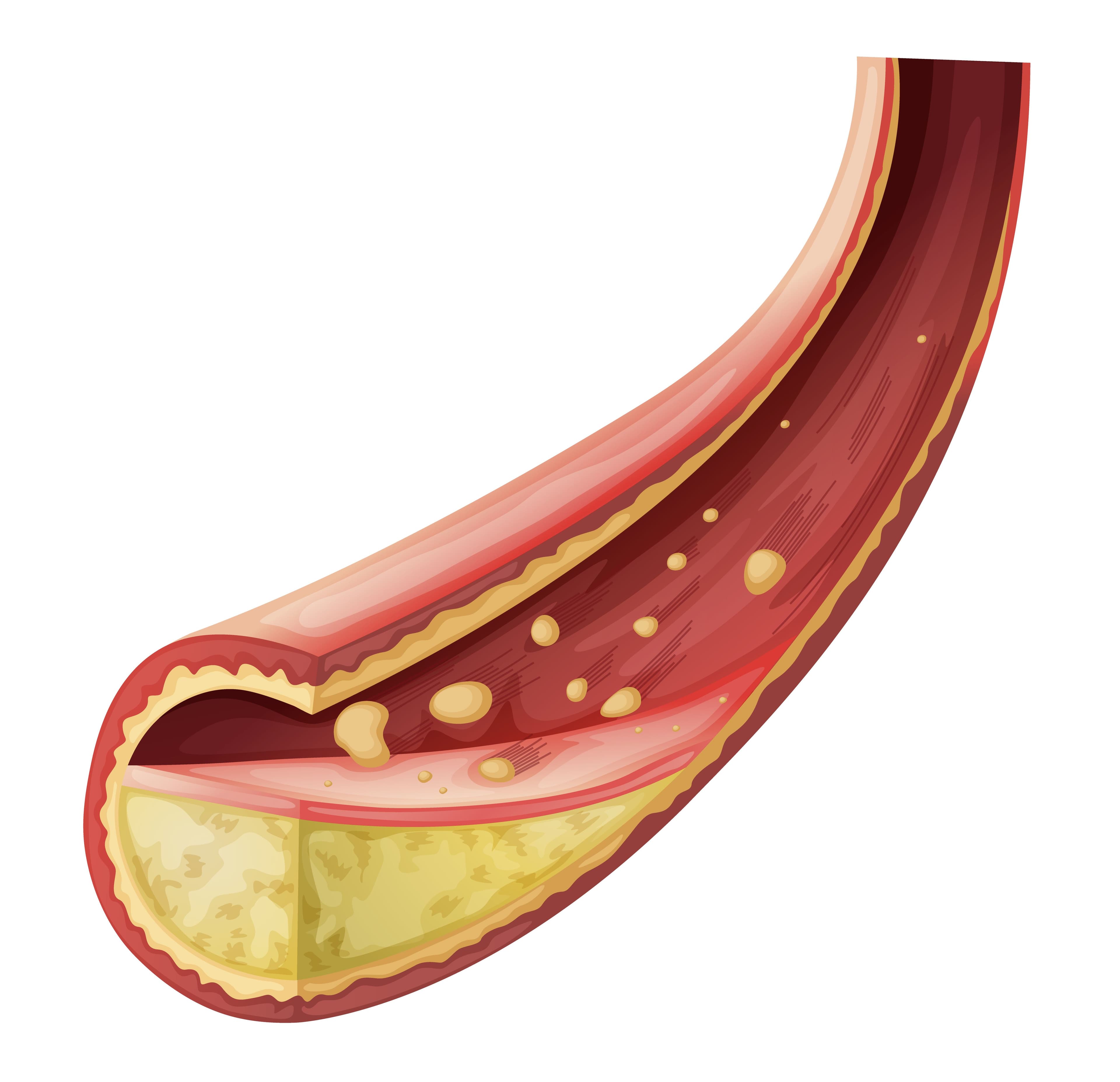 Overview of Established Risks Associated With Rosuvastatin Use