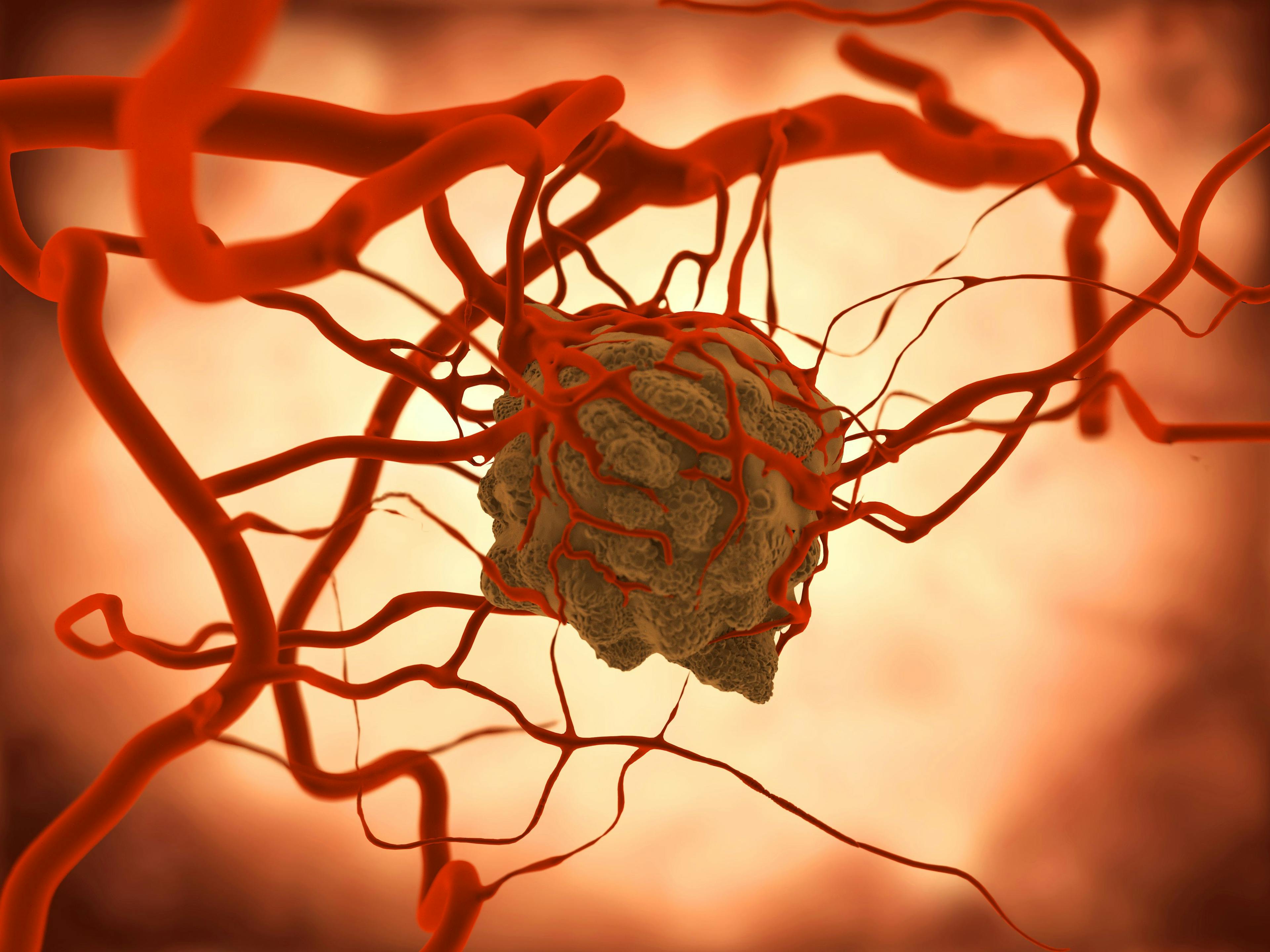 Neuroendocrine Tumor, FDA Orphan Drug | Image Credit: Juan Gärtner - stock.adobe.com