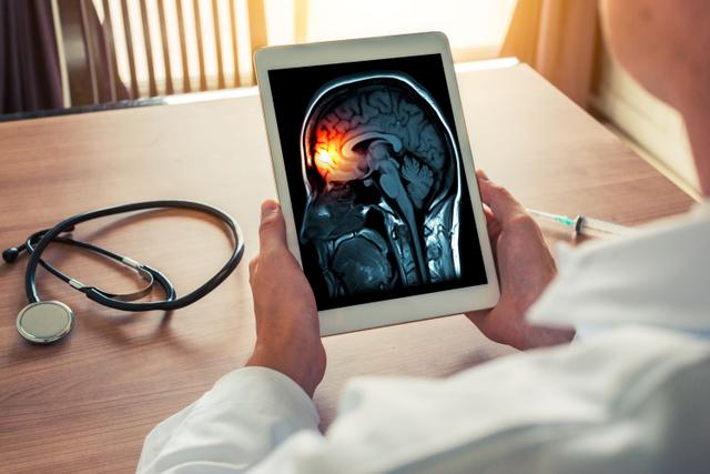 Doctor holding a digital tablet with x-ray of brain and skull skeleton. Headache, meningitis and migraine concept - Image credit: steph photographies | stock.adobe.com 