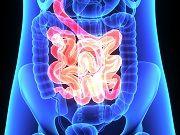 Repurposed Tapeworm Drug Shows Promise in Colon Cancer