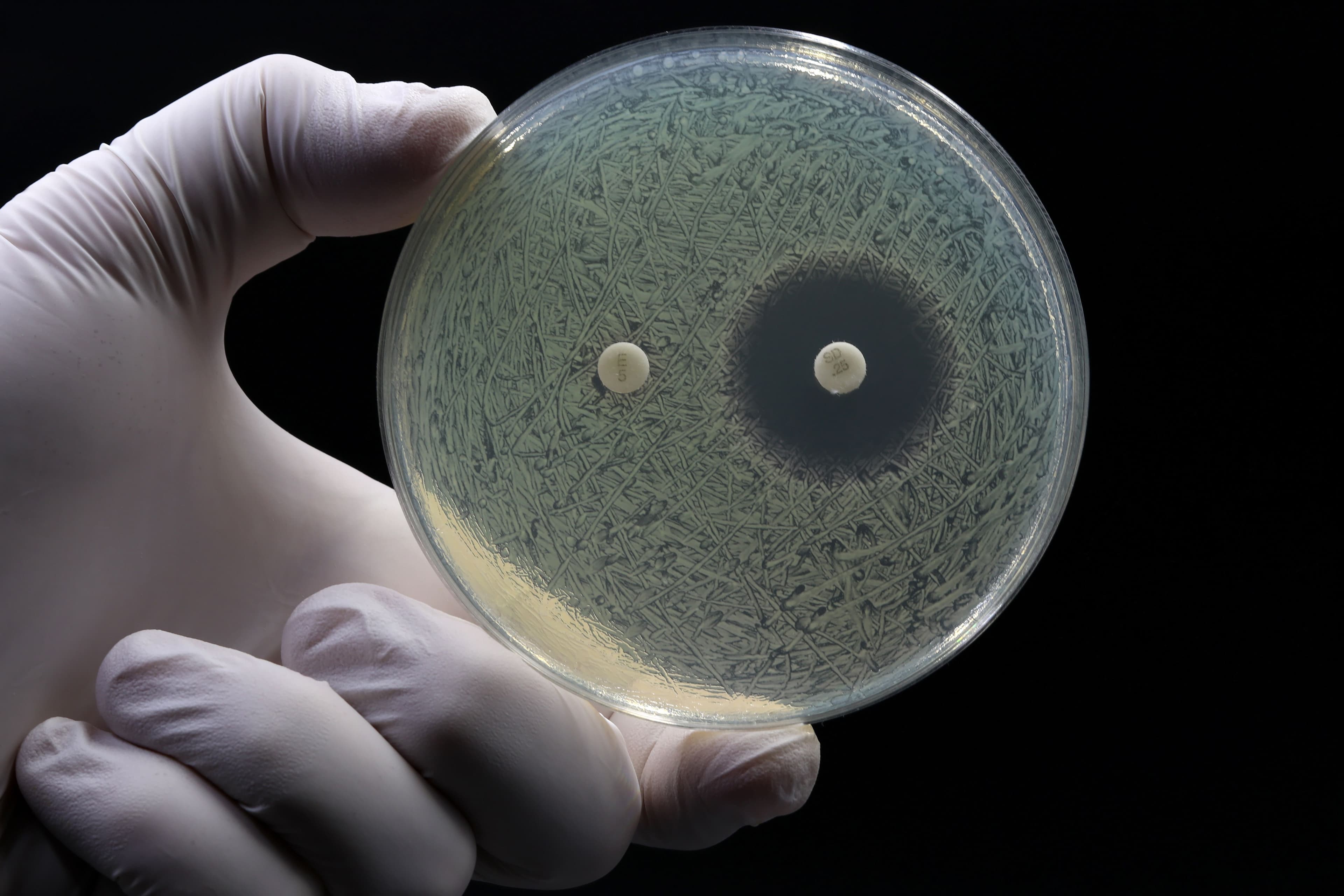 Researcher holding a petri dish with resistant bacteria