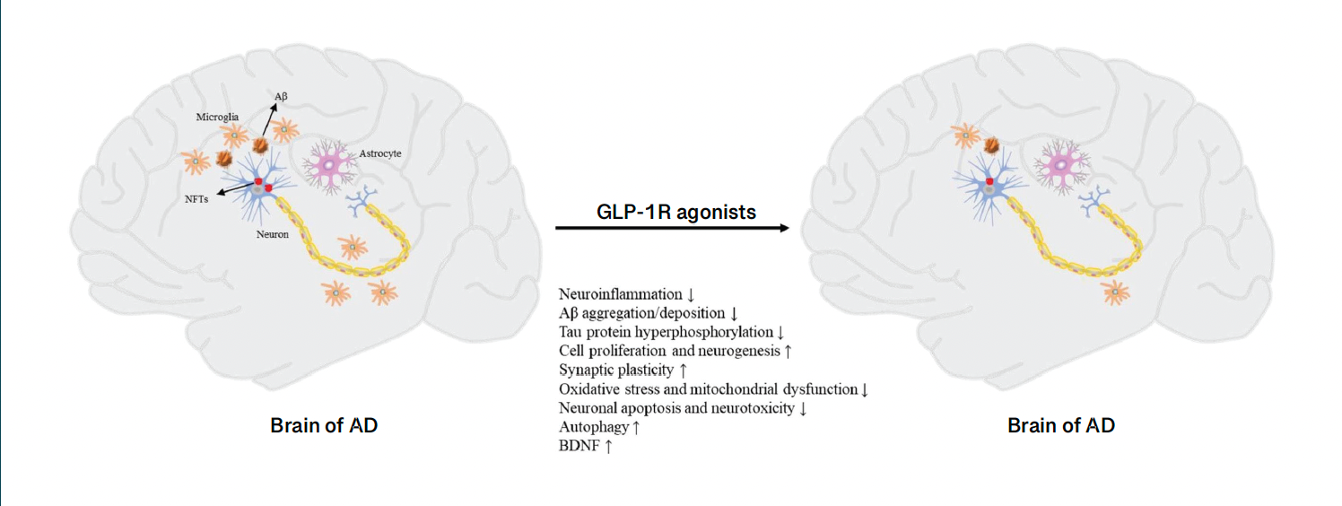 Figure 3: Pharmacology of GLP-1 Receptor Agonist Treatment in Patients With Alzheimer Disease  Aß, amyloid-ß; AD, Alzheimer disease; BDNF, brain-derived neurotrophic factor; GLP-1, glucagon-like peptide 1; NFT, neurofibrillary tangle.