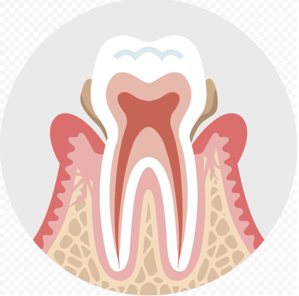 Pharmacy Clinical Pearl of the Day: Gingivitis