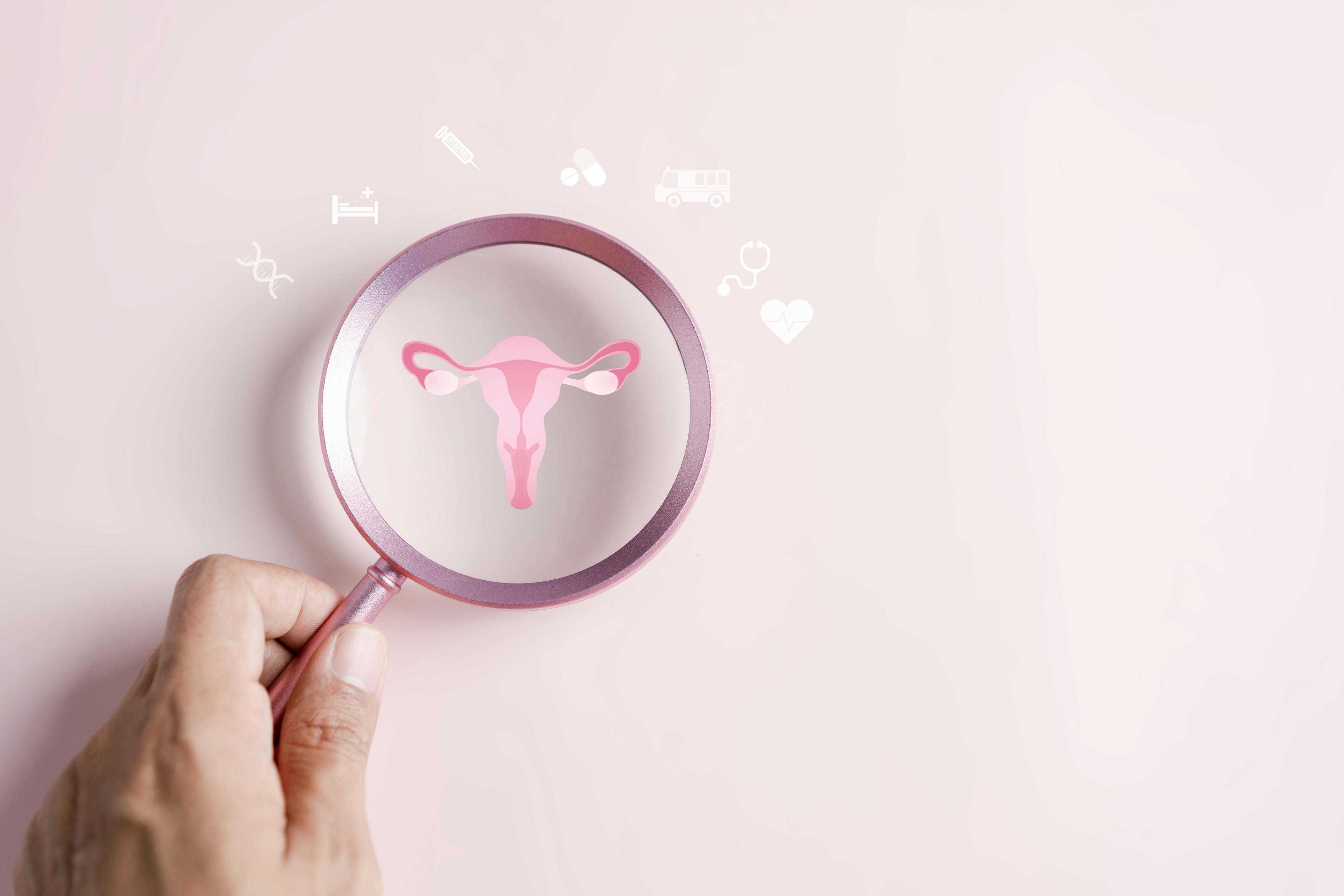 Checkup uterus reproductive system , women's health, PCOS, ovary cancer treatment and examine, Healthy feminine concept - Image credit: Kiattisak | stock.adobe.com