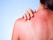 Late-Night Eating Could Increase Sunburn Risk