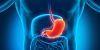 Inflammatory Bowel Disease May Be Inherited