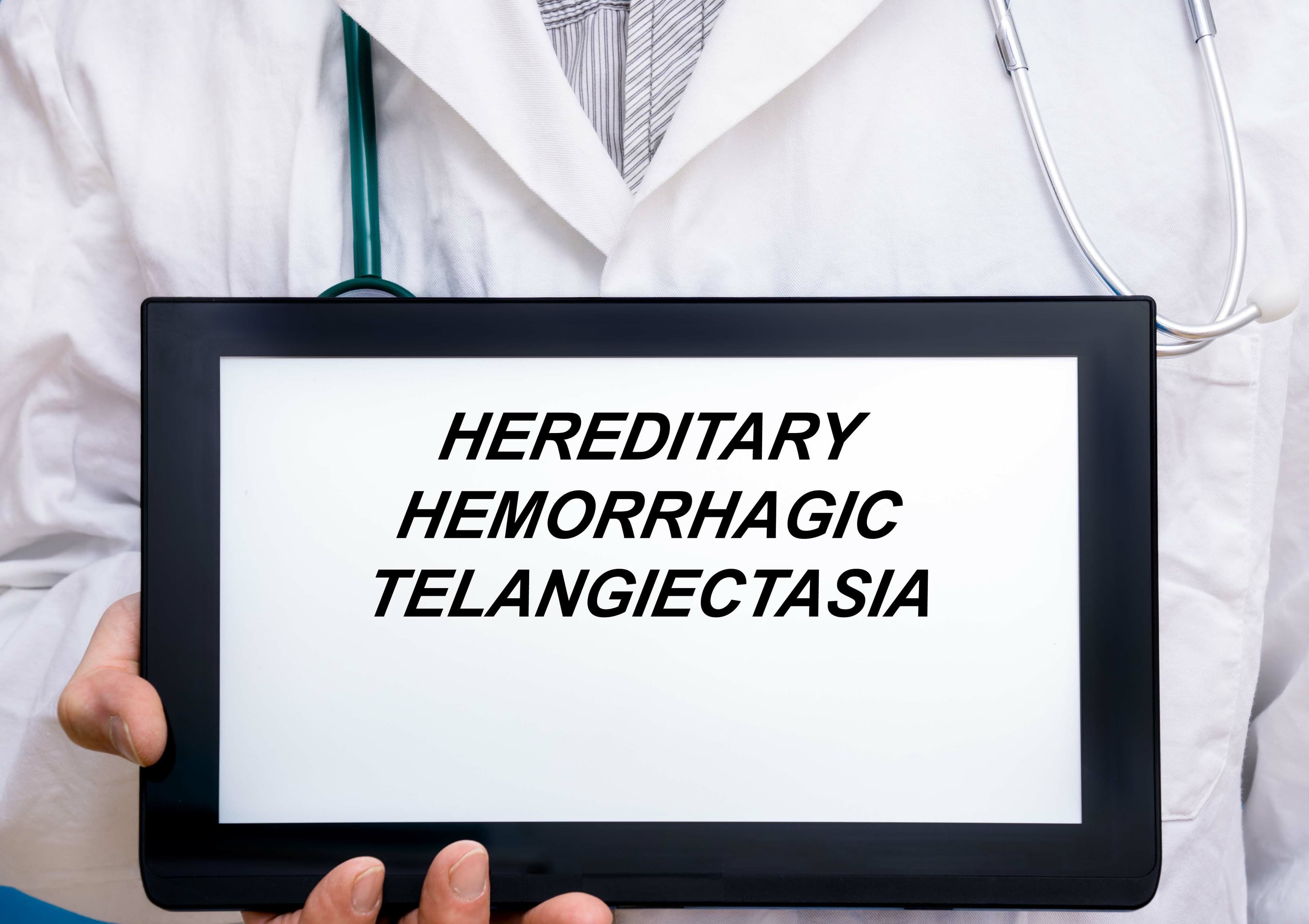 Hereditary hemorrhagic telangiectasia -- Image credit: luchschenF | stock.adobe.com