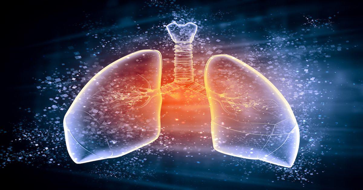 Discontinuation of Lumacaftor-Ivacaftor May Lead to Deterioration in Cystic Fibrosis